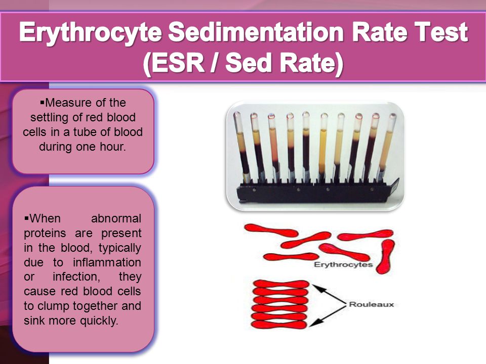 Erythrocyte sedimentation rate esr